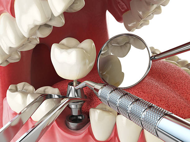 Best 24-Hour Emergency Dental Care in Queen Anne, MD